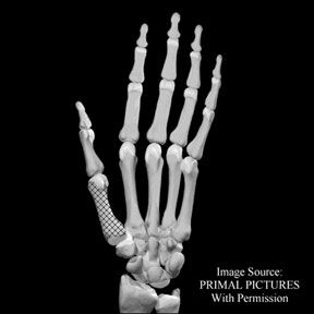 Gun Recoil's Effect on The Hand